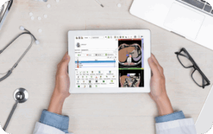 3d slicer for android
